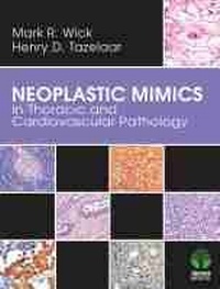 Enlarge image Cover: Neoplastic Mimics in Thoracic and Cardiovascular Pathology - Demos Medical Publishing