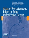 Bild: Atlas of Percutaneous Edge-to-Edge Mitral Valve Repair - Springer