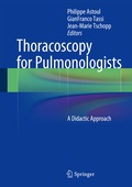 Bild: Thoracoscopy for Pulmonologists - Springer