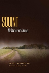 Enlarge image Cover: Squint - University Press of Mississippi