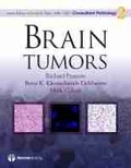 Cover: Brain Tumors - Demos Medical Publishing