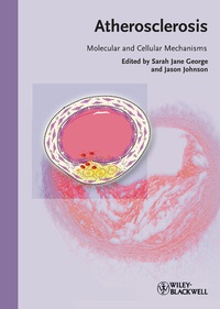 Abbildung von: Atherosclerosis - Wiley-Blackwell