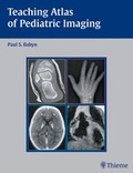 Cover: Teaching Atlas of Pediatric Imaging - Thieme Publishers