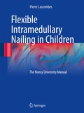 Bild: Flexible Intramedullary Nailing in Children - Springer