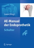 Cover: AE-Manual der Endoprothetik - Springer