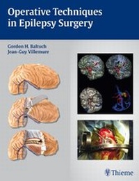 Enlarge image Cover: Operative Techniques in Epilepsy Surgery - Thieme Publishers