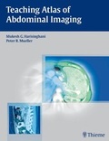 Cover: Teaching Atlas of Abdominal Imaging - Thieme Publishers