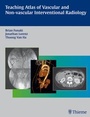 Cover: Teaching Atlas of Vascular and Non-vascular Interventional Radiology - Thieme Publishers
