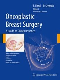 Bild vergrößern Bild: Oncoplastic Breast Surgery - Springer