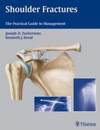 Abbildung von: Shoulder Fractures - Thieme Publishers