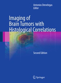 Abbildung von: Imaging of Brain Tumors with Histological Correlations - Springer