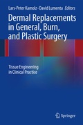 Abbildung von: Dermal Replacements in General, Burn, and Plastic Surgery - Springer