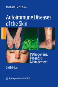 Bild vergrößern Bild: Autoimmune Diseases of the Skin - Springer
