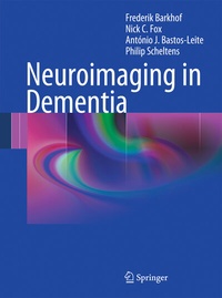 Abbildung von: Neuroimaging in Dementia - Springer
