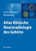 Cover: Atlas Klinische Neuroradiologie des Gehirns - Springer