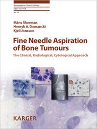 Abbildung von: Fine Needle Aspiration of Bone Tumours - S. Karger