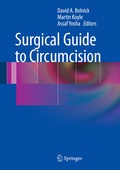 Cover: Surgical Guide to Circumcision - Springer
