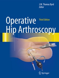 Abbildung von: Operative Hip Arthroscopy - Springer