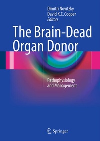 Abbildung von: The Brain-Dead Organ Donor - Springer