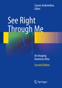 Abbildung von: See Right Through Me - Springer