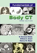 Cover: Fundamentals of Body CT - Saunders