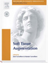 Enlarge image Cover: Soft Tissue Augmentation - Saunders