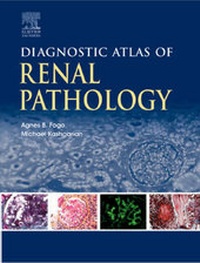 Abbildung von: Diagnostic Atlas of Renal Pathology - Saunders