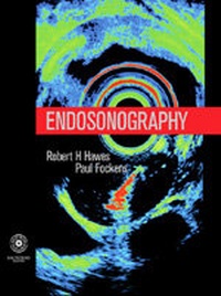 Abbildung von: Endosonography - Saunders