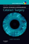 Cover: Surgical Techniques in Ophthalmology Series: Cataract Surgery - Saunders