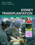 Cover: Kidney Transplantation - Saunders
