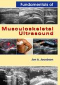 Cover: Fundamentals of Musculoskeletal Ultrasound - Saunders