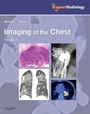 Cover: Imaging of the Chest, 2-Volume Set - Saunders
