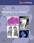 Cover: Imaging of the Chest, 2-Volume Set - Saunders
