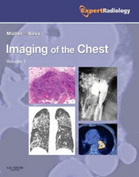 Enlarge image Cover: Imaging of the Chest, 2-Volume Set - Saunders