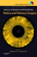 Cover: Surgical Techniques in Ophthalmology Series: Retina and Vitreous Surgery - Saunders