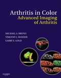 Cover: Arthritis in Color - Saunders