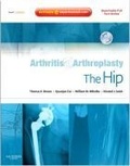 Cover: Arthritis and Arthroplasty: The Hip - Saunders