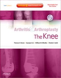Cover: Arthritis and Arthroplasty: The Knee - Saunders