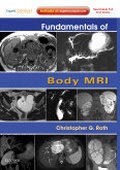 Cover: Fundamentals of Body MRI - Saunders