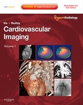 Cover: Cardiovascular Imaging, 2-Volume Set - Saunders