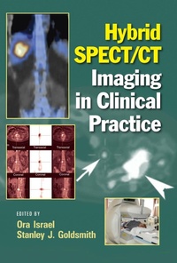 Abbildung von: Hybrid SPECT/CT Imaging in Clinical Practice - CRC Press
