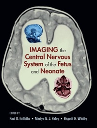 Abbildung von: Imaging the Central Nervous System of the Fetus and Neonate - CRC Press