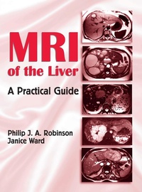 Abbildung von: MRI of the Liver - CRC Press