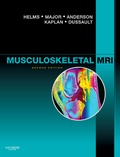 Cover: Musculoskeletal MRI - Saunders