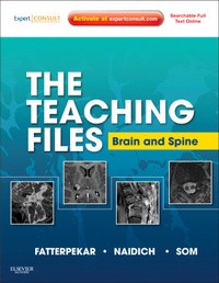 Enlarge image Cover: The Teaching Files: Brain and Spine - Saunders
