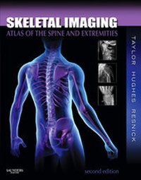 Abbildung von: Skeletal Imaging - Saunders