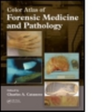Abbildung von: Color Atlas of Forensic Medicine and Pathology - CRC Press
