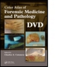 Abbildung von: Color Atlas of Forensic Medicine and Pathology, DVD - CRC Press