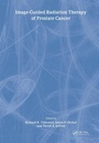 Cover: Image-Guided Radiation Therapy of Prostate Cancer - CRC Press