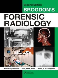 Abbildung von: Brogdon's Forensic Radiology - CRC Press